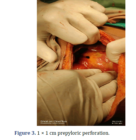 experimental-surgery-perforation